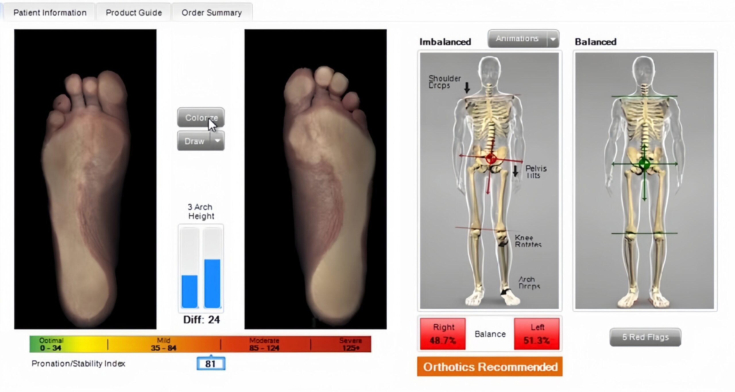 Foot scan results showing pressure distribution and arch analysis at Kamego Chiropractic Almont MI Lapeer County